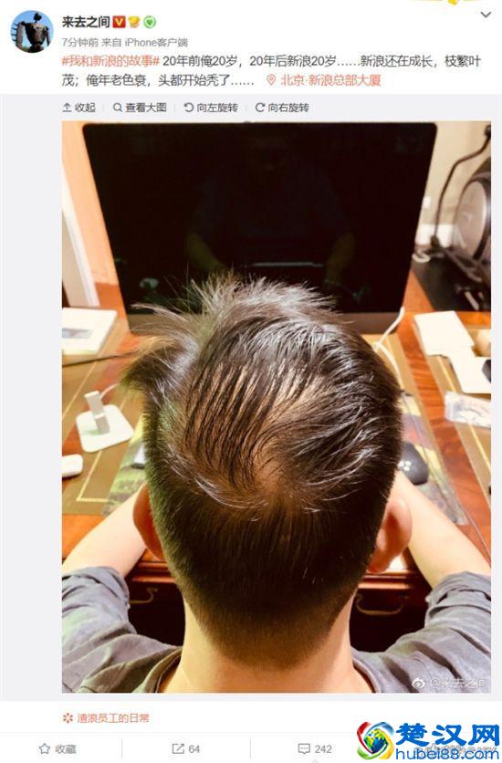 新浪20岁生日，微博CEO晒后脑勺照片：头开始秃了