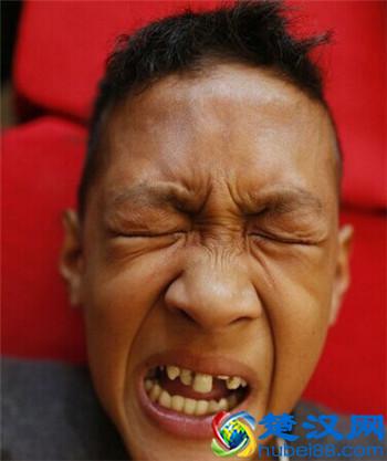 菲律宾数百名男孩行割礼 隔着屏幕就感到了疼