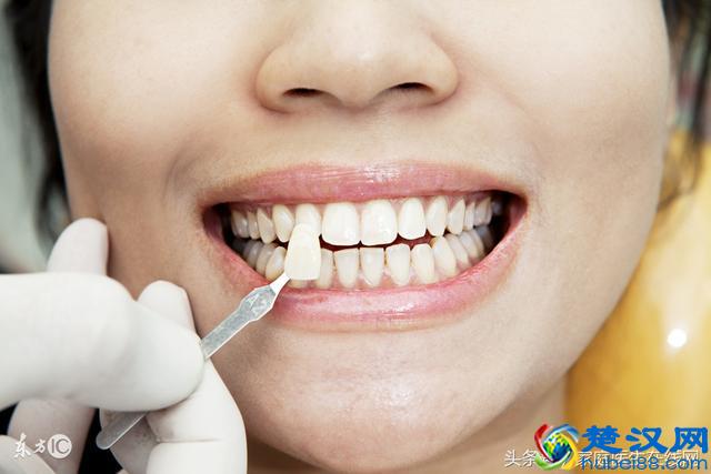 5个原因会让牙齿变黄，美白牙膏的原理是什么？让你秒懂