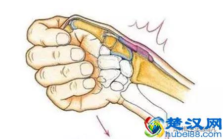 “打封闭”到底是好还是不好？哪些病可以打？