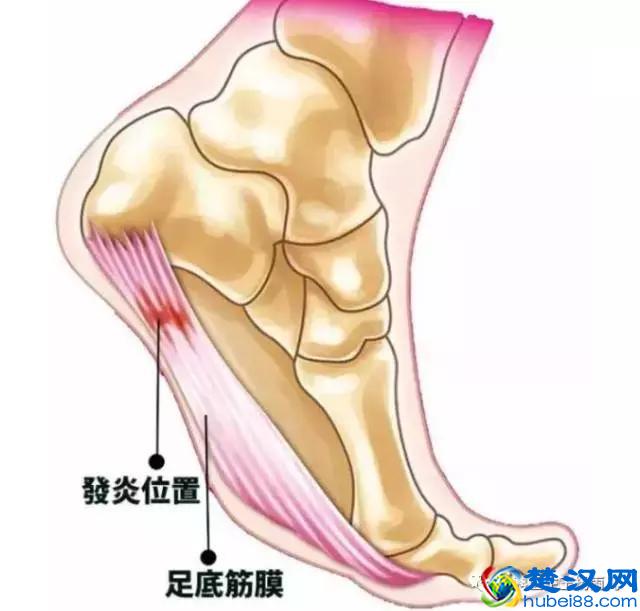 “打封闭”到底是好还是不好？哪些病可以打？