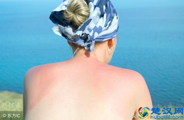 皮肤被晒伤后该怎么办？7个应对措施，帮你“修复”皮肤