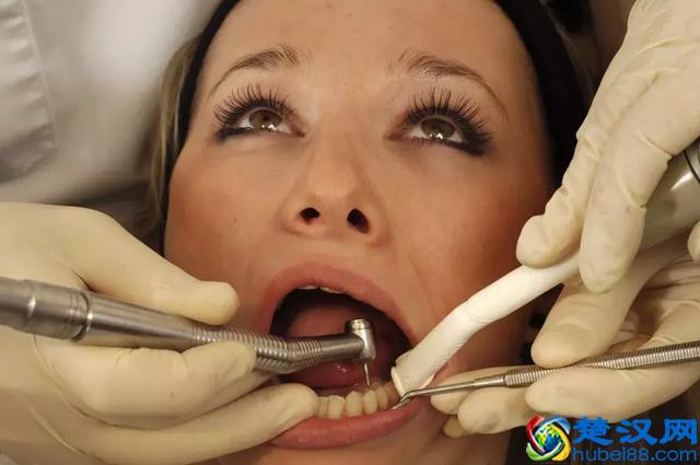 补牙用什么材料好？