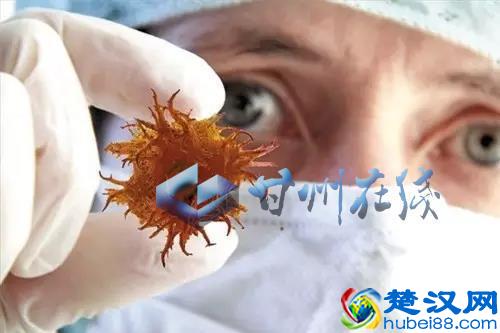 关于白色污染，您需要知道哪些？