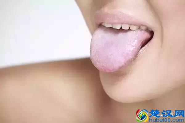 舌苔厚白是怎么回事 教你从舌苔中判断健康情况