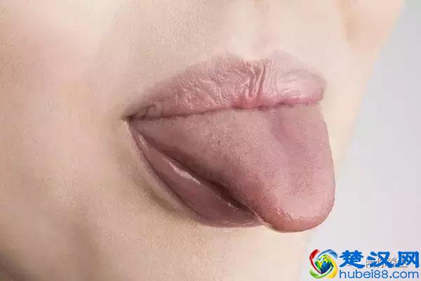 舌苔厚白是怎么回事 教你从舌苔中判断健康情况