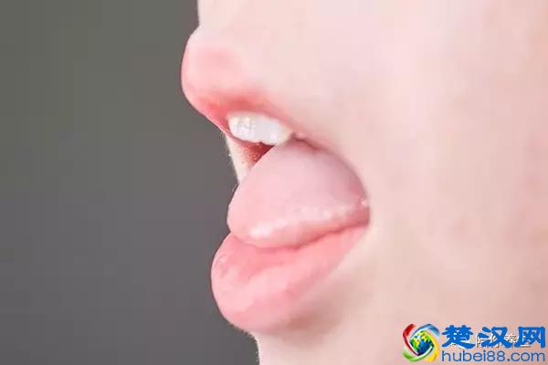 舌苔厚白是怎么回事 教你从舌苔中判断健康情况