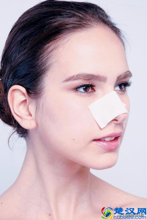 8个小窍门有效去黑头，你不妨试试
