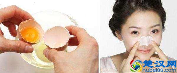 如何正确去黑头，尤其是鼻子？你需要知道的去黑头大全