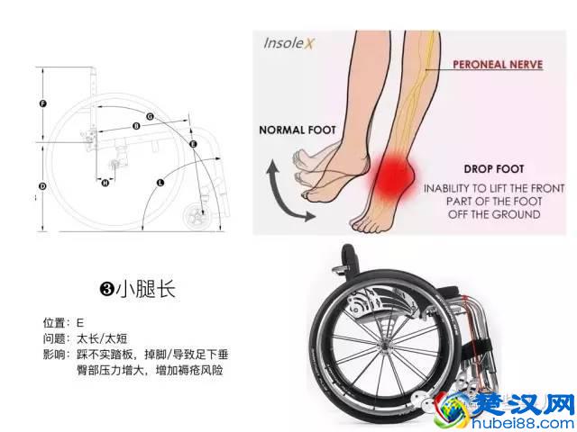 你应该知道的进口定制轮椅量身，没看的都吃亏了！