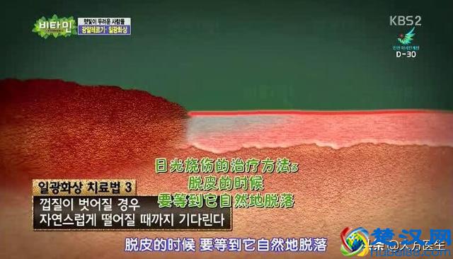 皮肤晒伤后怎么办？教你几招快速修复方法