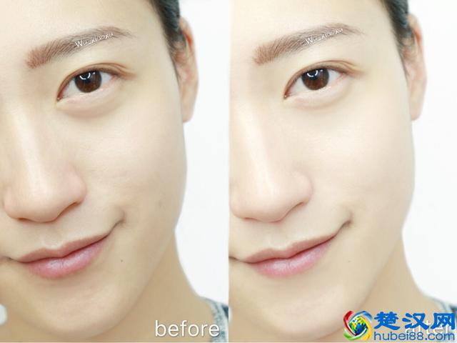 禾博士维生素C咀嚼片，轻松拥有美白肌