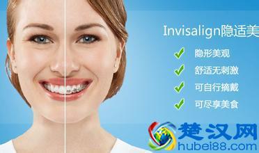 隐形牙齿矫正价格如何？贵不贵呢？