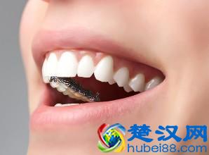 隐形牙齿矫正价格如何？贵不贵呢？