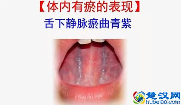 月经期间吃什么好排毒排污血？排尽血块更健康！