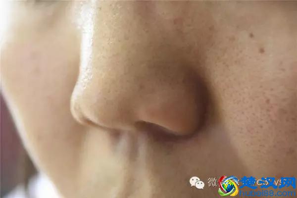 十人九痔 痔疮久拖不治 到底会有哪些危害呢