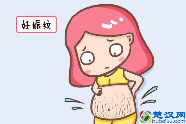 妊娠纹并不是每个孕妈都会有，这三种类型的孕妈就不会有，你是吗