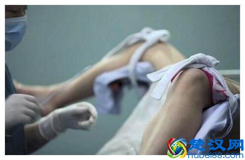 吃打胎药后以为已经流产，五个月后检查看到胎儿手足无措