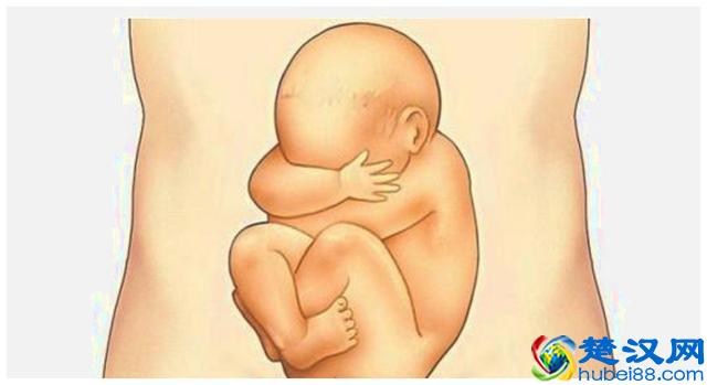 吃打胎药后以为已经流产，五个月后检查看到胎儿手足无措