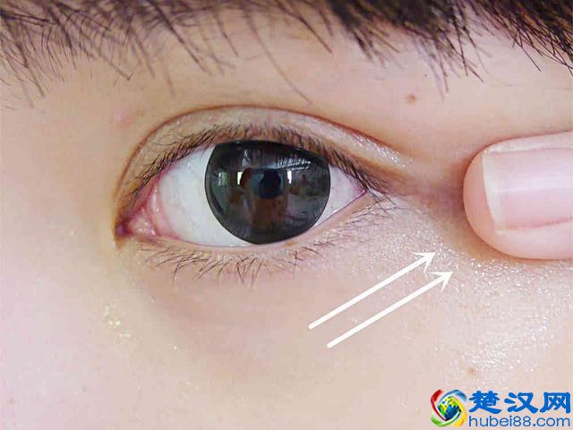 去除眼袋的6个小窍门，朋友们知道吗？