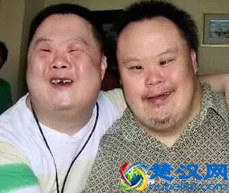 怀孕15周要唐氏筛查，筛查的方法是什么？准妈要做什么准备？