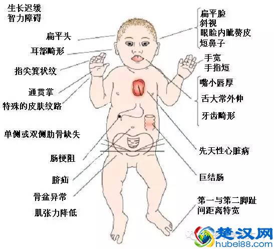 怀孕15周要唐氏筛查，筛查的方法是什么？准妈要做什么准备？