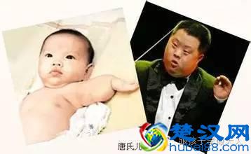 怀孕15周要唐氏筛查，筛查的方法是什么？准妈要做什么准备？