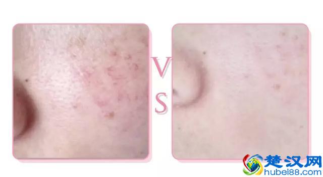 几十块的乳液保湿还美白，每天抹效果堪比sk2！