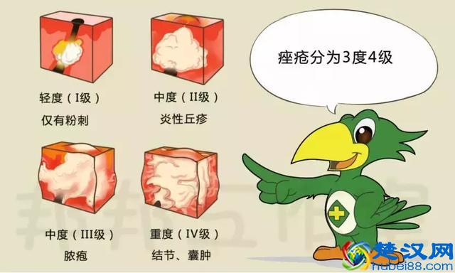 白头、黑头粉刺此起彼伏，皮肤科专家教你怎样才能去除？