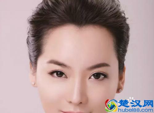 天生发际线高还有救吗？最全解决办法总结