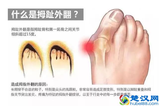 夏天必备15双超美腻单鞋！腿粗脚宽也能穿！