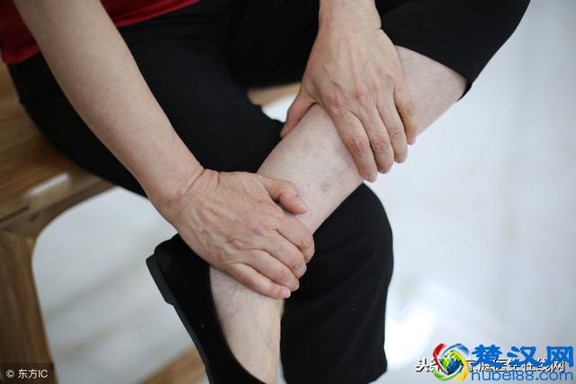 总掉头发是缺维生素 ? 身体4种不同症状，告诉你缺哪些维生素