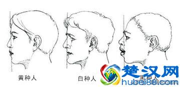 龅牙凸嘴又想变漂亮怎么办？