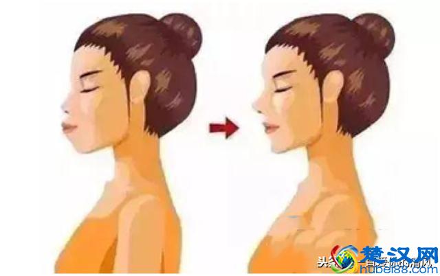 龅牙凸嘴又想变漂亮怎么办？