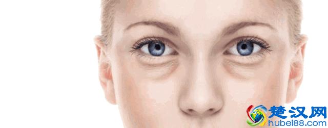 眼袋、泪沟、黑眼圈！我该拿你怎么办？