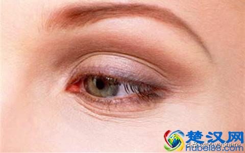 眼袋、泪沟、黑眼圈！我该拿你怎么办？