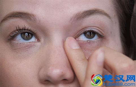 眼袋、泪沟、黑眼圈！我该拿你怎么办？