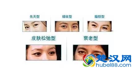 眼袋浮肿是什么原因？消除眼袋浮肿的方法