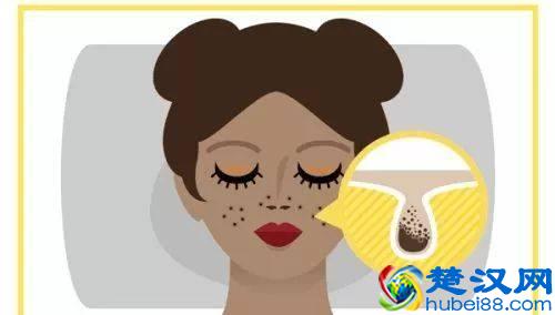 让毛孔变小，有哪些方法你都知道吗？