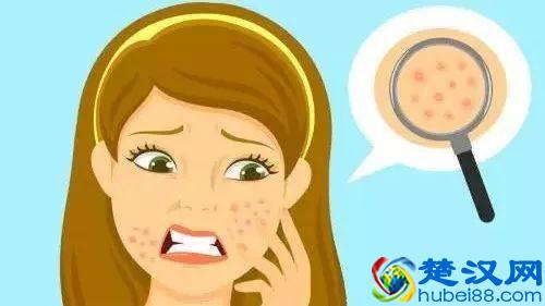 让毛孔变小，有哪些方法你都知道吗？