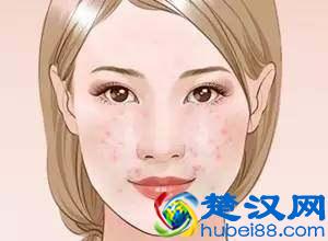 让毛孔变小，有哪些方法你都知道吗？