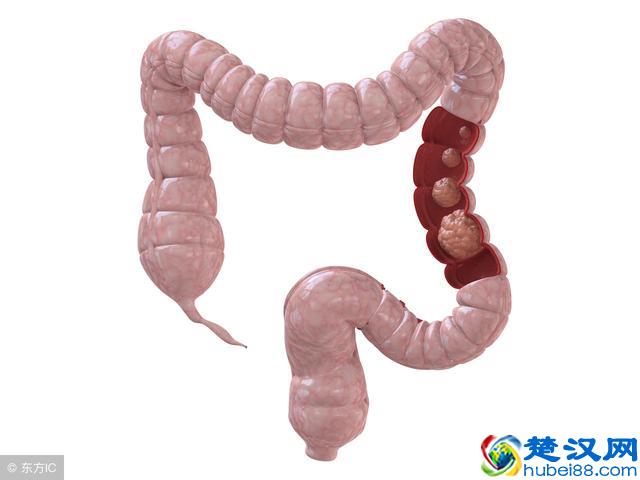 为什么有的人怎么吃都吃不胖？原因可能是这3个