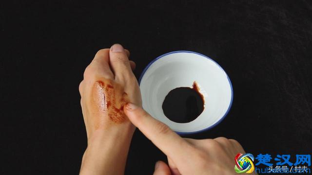 不小心被烫伤怎么处理，告诉你一个农村土方法，止痛快不起泡留疤