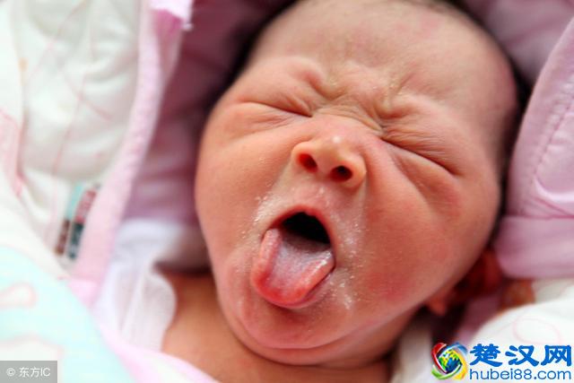 新生儿的脸蛋干燥又脱皮，到底正不正常？