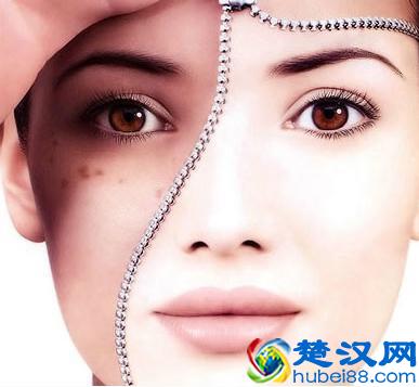 脸上难看的痘印要怎么去除