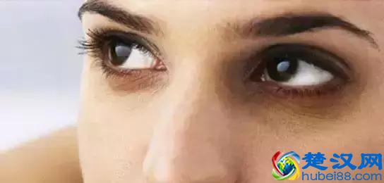 如何祛除眼袋黑眼圈？靠谱的方法在这里