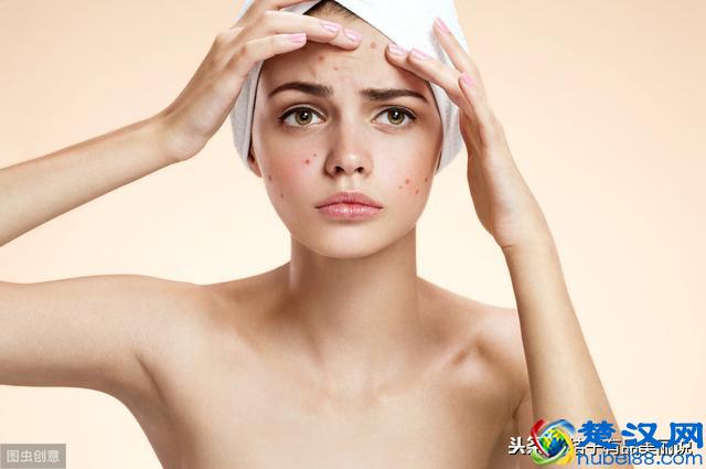 女生如何去黑头，告别草莓鼻