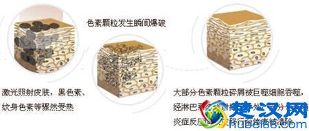 眼睛下面长斑的原因 你知道多少呢?