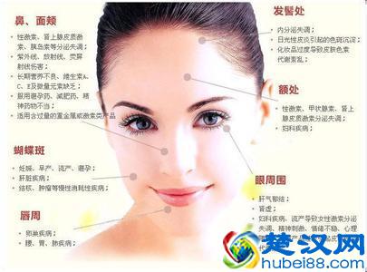 女性蝴蝶斑产生原因及去除方法