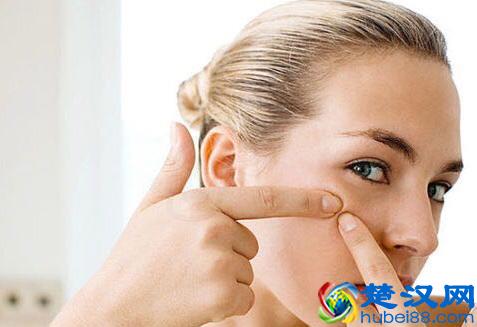 总喜欢挤痘痘，留下满脸的痘印和痘坑，怎么办啊？